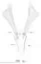 Fig. 56 - Suturing devices and methods for suturing an anatomic valve