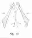 Fig. 60 - Suturing devices and methods for suturing an anatomic valve