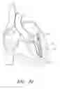 Fig. 62 - Suturing devices and methods for suturing an anatomic valve