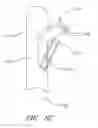 Fig. 63 - Suturing devices and methods for suturing an anatomic valve