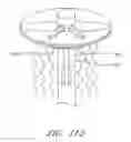 Fig. 88 - Suturing devices and methods for suturing an anatomic valve