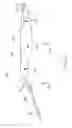 Fig. 04 - SURGICAL HANDPIECE, LIQUID EJECTING APPARATUS, AND ASPIRATION APPARATUS