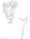 Fig. 04 - System for treating bone fractures