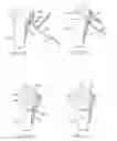 Fig. 28 - System for treating bone fractures