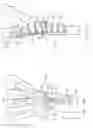 Fig. 41 - System for treating bone fractures