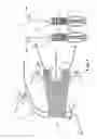 Fig. 02 - Tissue anchor system including a suture securing an anchor to a support