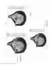 Fig. 07 - Polymeric heart valve