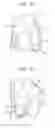 Fig. 08 - Subtalar joint implant