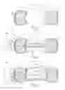 Fig. 02 - Percutaneous implantable nuclear prosthesis
