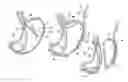 Fig. 01 - Devices and methods facilitating sleeve gastrectomy procedures