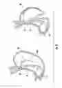 Fig. 09 - Devices and methods facilitating sleeve gastrectomy procedures