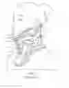 Fig. 02 - Cervical collar having height adjustment