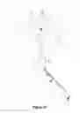 Fig. 09 - APPARATUS AND METHOD FOR MUSCLE, CENTRAL NERVOUS SYSTEM AND VISCERA STIMULATION FOR WHEELCHAIR BOUND PERSONS