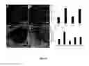 Fig. 07 - Compositions and Methods of Using Interleukin-4 Induced Gene 1 (IL-4I1)