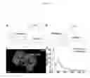 Fig. 02 - Peptide reagents and methods for detection and targeting of dysplasia, early cancer and cancer