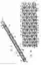 Fig. 03 - HYBRID STENT AND METHOD OF MAKING