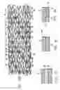 Fig. 04 - HYBRID STENT AND METHOD OF MAKING