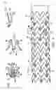 Fig. 05 - HYBRID STENT AND METHOD OF MAKING