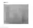 Fig. 06 - Anisotropic biocomposite material, medical implants comprising same and methods of treatment thereof