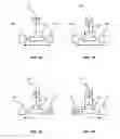 Fig. 02 - DEVICES AND METHODS FOR DRAINAGE, INFUSION, OR INSTILLATION OF FLUIDS