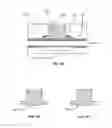 Fig. 07 - DEVICES AND METHODS FOR DRAINAGE, INFUSION, OR INSTILLATION OF FLUIDS