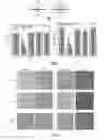 Fig. 02 - Implantable Electrode