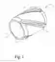 Fig. 02 - APPLYING RFID TAGS TO TUBULAR COMPONENTS BY INJECTION MOLDING