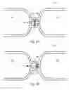 Fig. 08 - Segmented inner tube