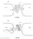 Fig. 09 - Segmented inner tube