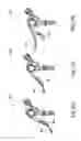Fig. 49 - Lever assembly for positive lock adjustable seat post