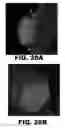 Fig. 43 - Compounds and methods for treating bacterial infections