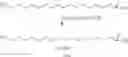 Fig. 35 - Sulfoperoxycarboxylic acids, their preparation and methods of use as bleaching and antimicrobial agents