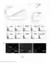 Fig. 02 - PROGENITOR CELLS, METHOD FOR PREPARATION THEREOF AND USES THEREOF