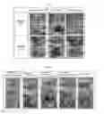 Fig. 02 - Medium composition for preparing botulinum toxin