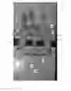 Fig. 01 - Fence support system