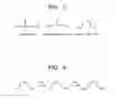 Fig. 07 - MOLECULAR DETECTION APPARATUS AND MOLECULAR DETECTION METHOD