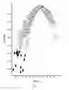 Fig. 02 - BIOMARKERS PREDICTIVE OF MUSCLE ATROPHY, METHOD AND USE