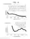 Fig. 04 - Coated optical fiber and method for manufacturing coated optical fiber