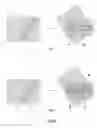 Fig. 04 - Method, device and laser scanning microscope for generating rasterized images