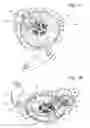 Fig. 02 - Method for attachment of a balance spring for a mechanical timepiece movement and balance spring attached by such a method