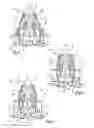 Fig. 04 - Thermostatic valve having a sleeve