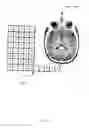 Fig. 06 - Method, system and apparatus for quantitative surgical image registration
