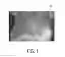 Fig. 02 - Software tool for breast cancer screening