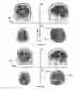 Fig. 09 - System and method for image processing