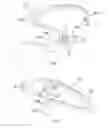Fig. 02 - Process and wearable device equipped with stereoscopic vision for helping the user