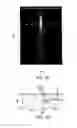 Fig. 03 - Planar immersion lens with metasurfaces