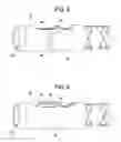 Fig. 04 - Deflecting endoscope accessory channels