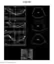 Fig. 15 - Ultrasonic diagnostic apparatus and image processing method
