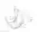 Fig. 01 - Diaper adapted for collection of urine sample from an infant
