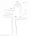Fig. 01 - Shape-memory polymer foam device for treating aneurysms